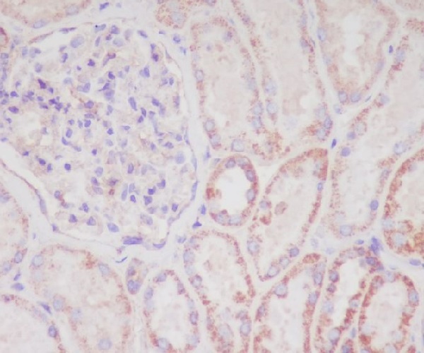 SMAC Rabbit mAb ABZ4840