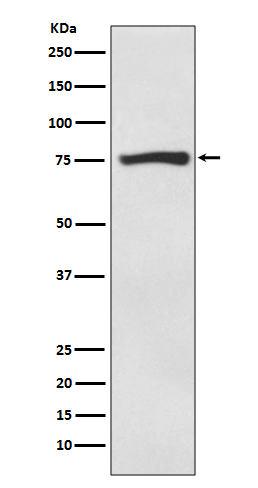 ACSS2 Rabbit mAb ABZ4841