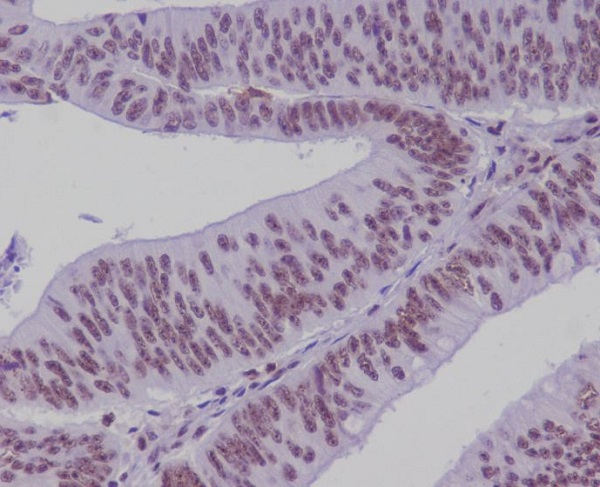 TCF4 Rabbit mAb ABZ4842