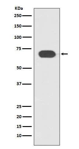 TCF4 Rabbit mAb ABZ4842