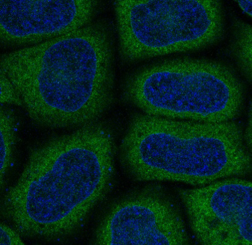 LC3A Rabbit mAb ABZ4843