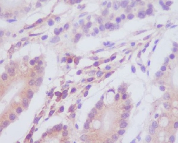 LC3A Rabbit mAb ABZ4843