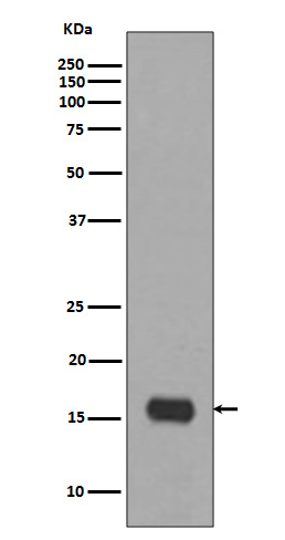 LC3A Rabbit mAb ABZ4843