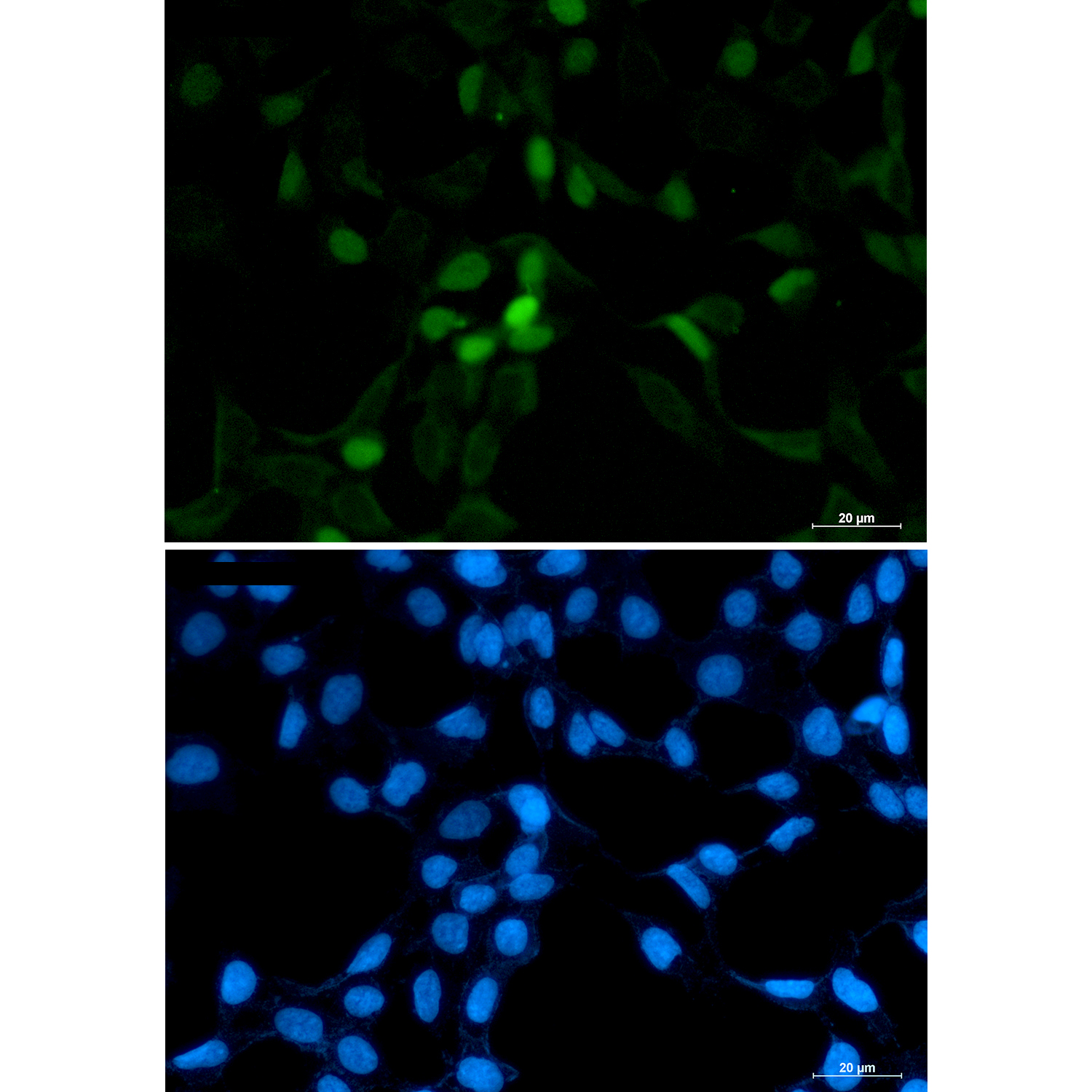 CDT1/DUP Rabbit mAb ABZ4844
