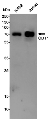 CDT1/DUP Rabbit mAb ABZ4844