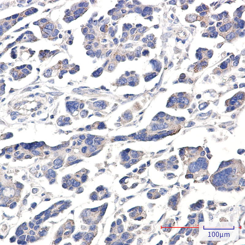APG5L/ATG5 Rabbit mAb ABZ4845