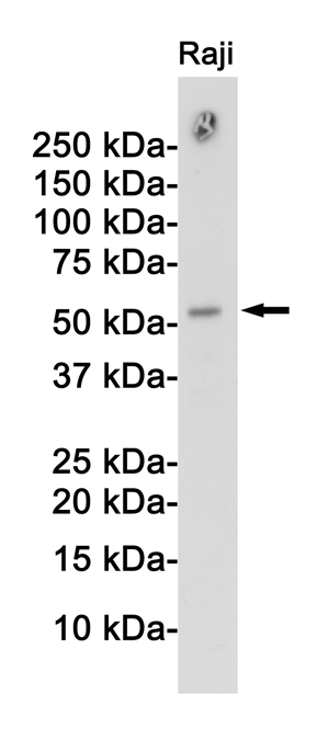 APG5L/ATG5 Rabbit mAb ABZ4845