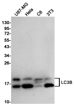 LC3B Rabbit mAb ABZ4846