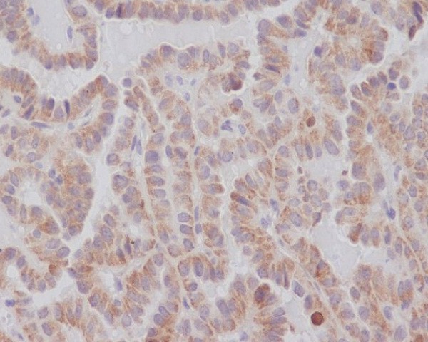 KIFC1 Rabbit mAb ABZ4847