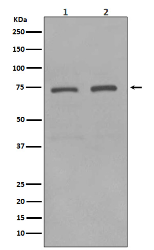 KIFC1 Rabbit mAb ABZ4847