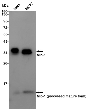 GDF15 Rabbit mAb ABZ4848
