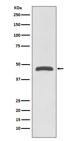 TSG101 Rabbit mAb ABZ4849