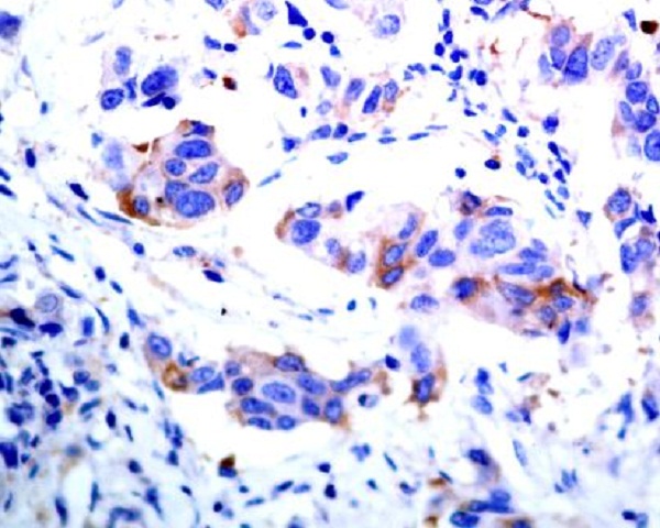 ASK1 Rabbit mAb ABZ4850