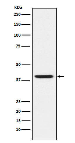 RING2 / RING1B / RNF2 Rabbit mAb ABZ4851