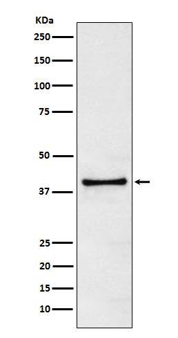 TRIB3 Rabbit mAb ABZ4853