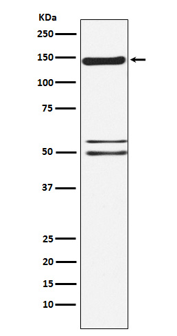 SynGAP Rabbit mAb ABZ4854