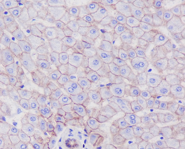 SR-BI Rabbit mAb ABZ4861