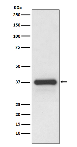 Podoplanin Rabbit mAb ABZ4862