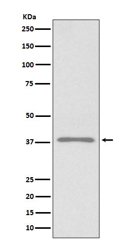 Podoplanin Rabbit mAb ABZ4863