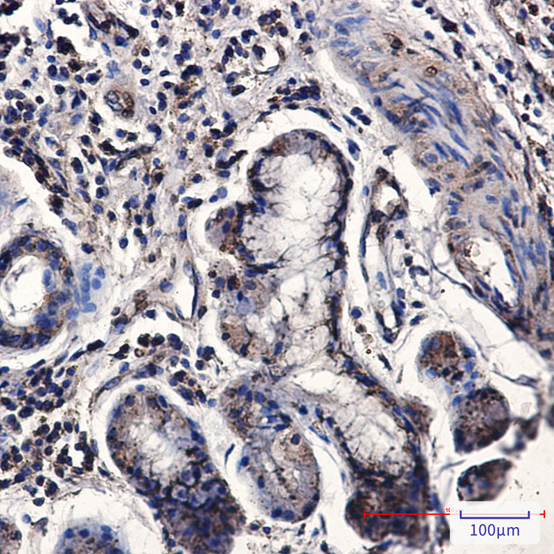 CNOT7 Rabbit mAb ABZ4866