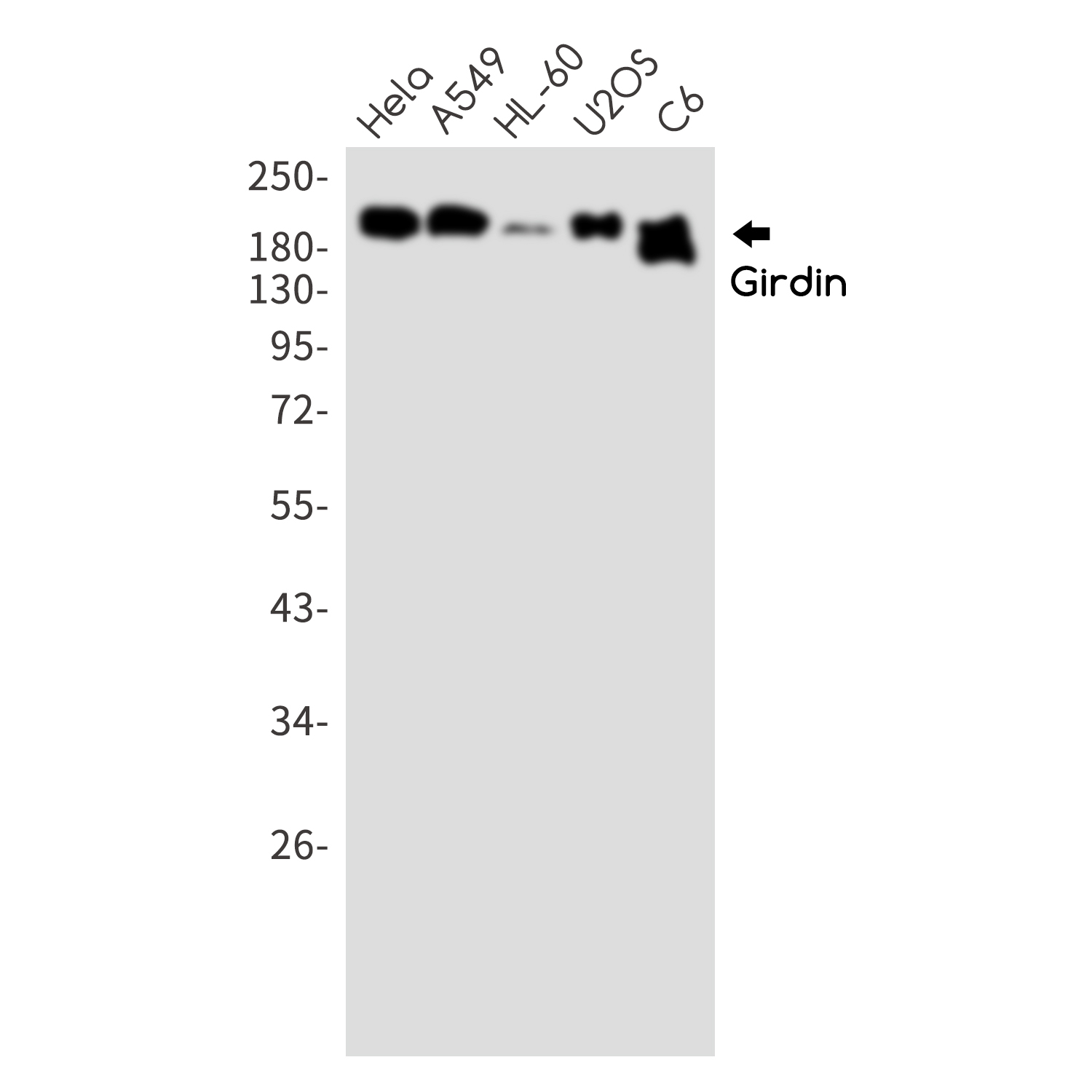 GIV Rabbit mAb ABZ4867