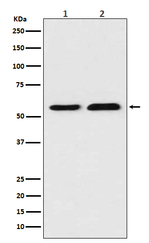 TXNRD1 Rabbit mAb ABZ4868
