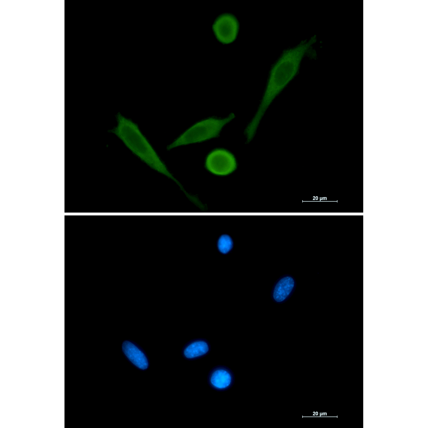 Fascin Rabbit mAb ABZ4869