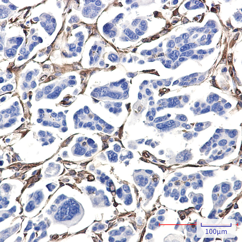 Fascin Rabbit mAb ABZ4869