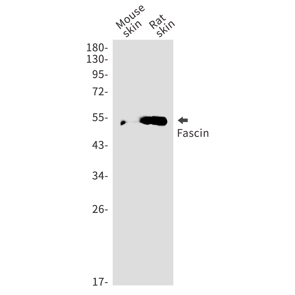 Fascin Rabbit mAb ABZ4869