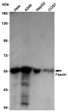 Fascin Rabbit mAb ABZ4869