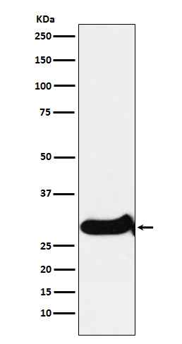 IGFBP7 Rabbit mAb ABZ4873