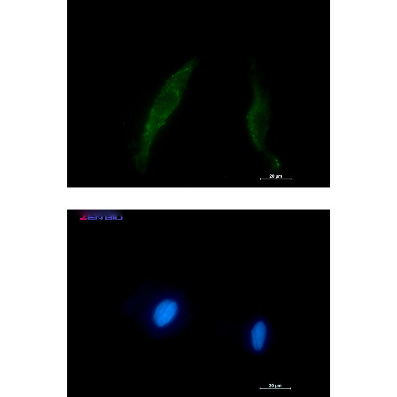 Smad2/3 Rabbit mAb ABZ4875