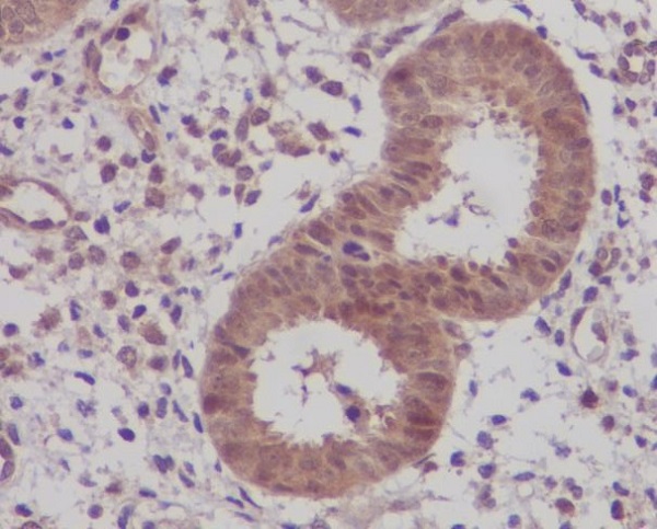IKB beta Rabbit mAb ABZ4877