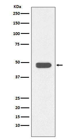 IKB beta Rabbit mAb ABZ4877