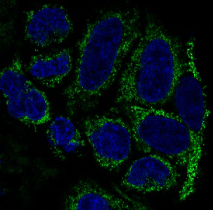 TOMM20 Rabbit mAb ABZ4878