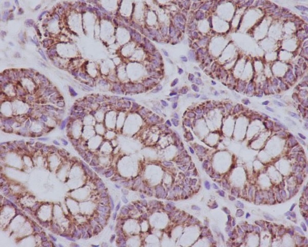 TOMM20 Rabbit mAb ABZ4878
