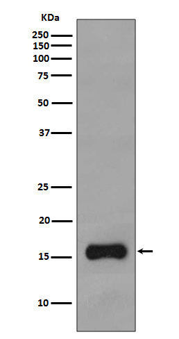 TOMM20 Rabbit mAb ABZ4878