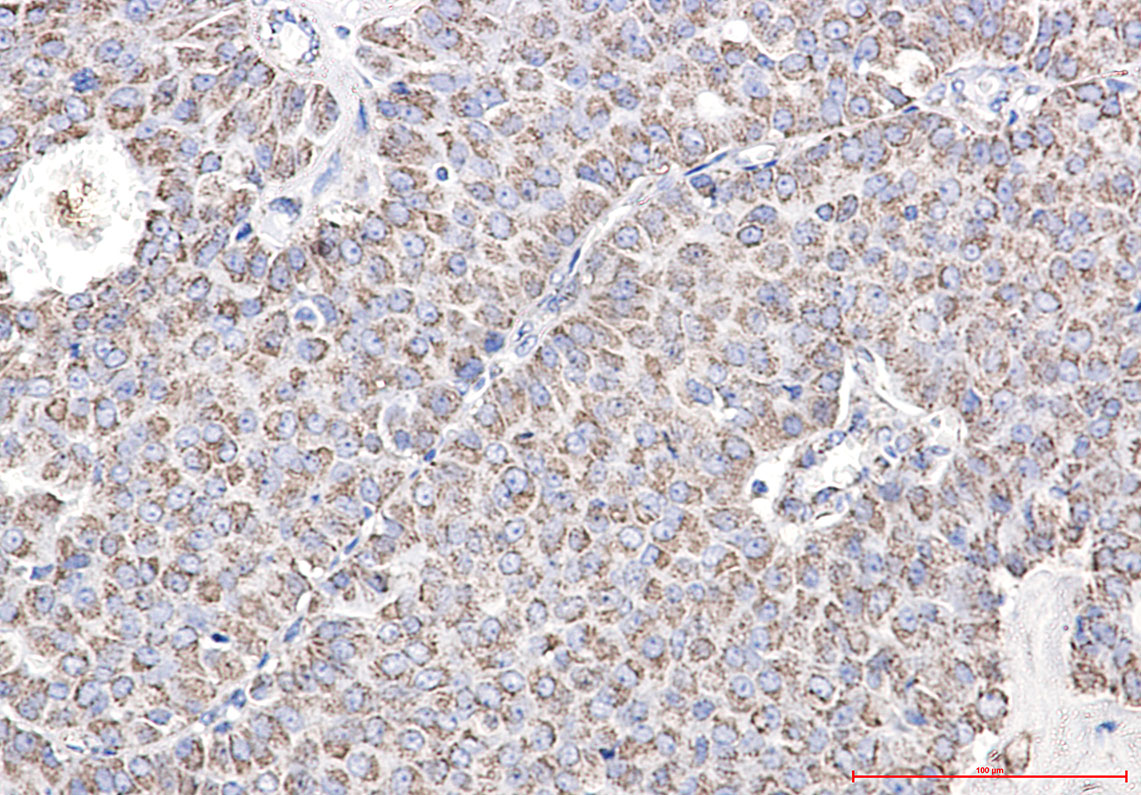 TOMM20 Rabbit mAb ABZ4879