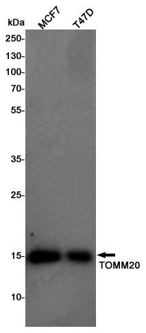 TOMM20 Rabbit mAb ABZ4879