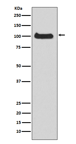 PKC mu/PKD Rabbit mAb ABZ4880