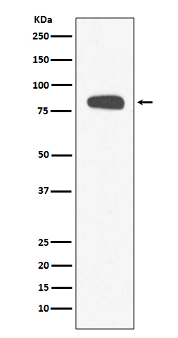 Stromal Interaction Molecule 1 Rabbit mAb ABZ4886