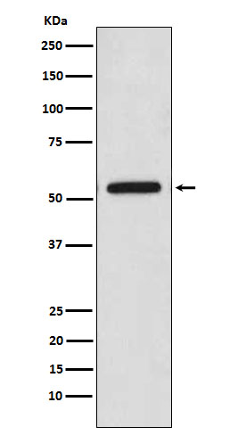 CaMKII Rabbit mAb ABZ4887