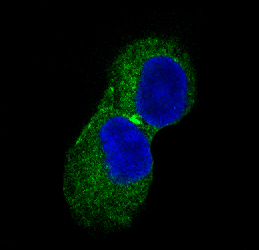 CaMKII Rabbit mAb ABZ4888