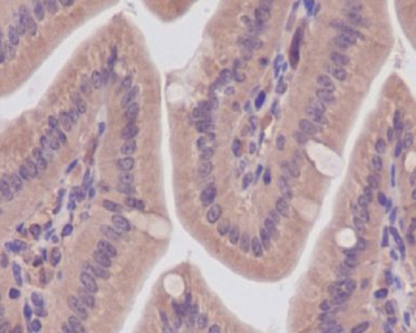 CaMKII Rabbit mAb ABZ4888