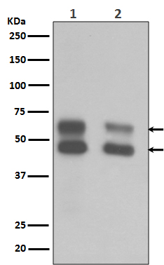 CaMKII Rabbit mAb ABZ4888