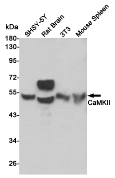CaMKII Rabbit mAb ABZ4888