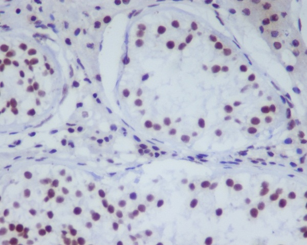 HDAC1 Rabbit mAb ABZ4889