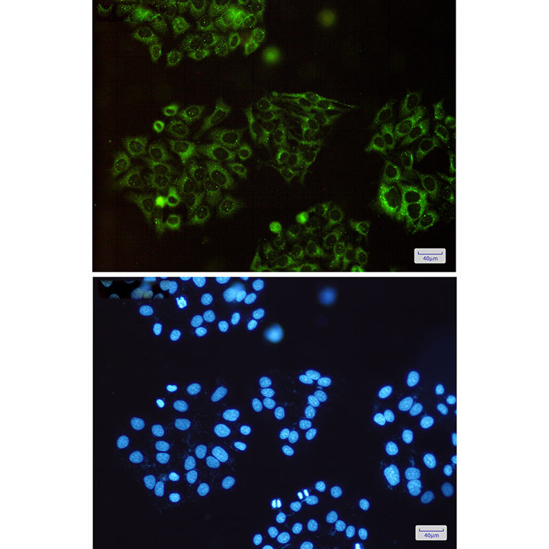 SQSTM1/p62 Rabbit mAb ABZ4890