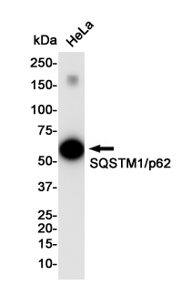 SQSTM1/p62 Rabbit mAb ABZ4890