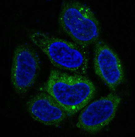 SQSTM1/p62 Rabbit mAb ABZ4891